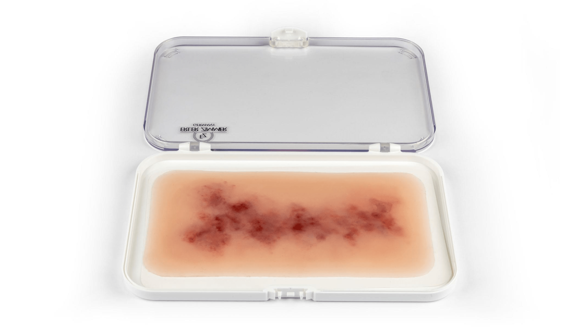 Wundmoulage Hämatom älter - Erler - Zimmer